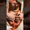 Human Digestive System | Human Anatomy | Bio AI Art | 20