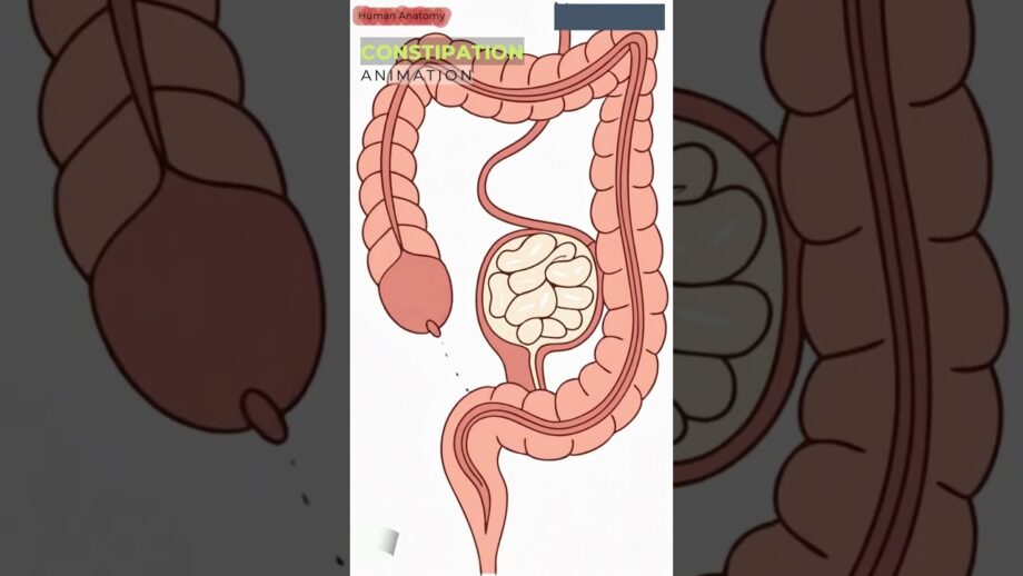 Constipation Blocking the Colon Lumen | Human Anatomy | Digestive System | Gut AI Art | 17