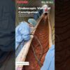 Endoscopic View of Constipation | Animation | Digestive System | Human Anatomy | Bio AI Art | 10