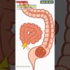 Constipation Blocking the Colon Lumen | Human Anatomy | Digestive System | Gut AI Art | 15
